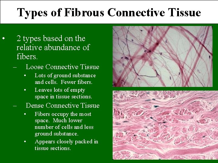 Types of Fibrous Connective Tissue • 2 types based on the relative abundance of