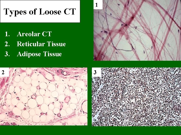 Types of Loose CT 1 1. Areolar CT 2. Reticular Tissue 3. Adipose Tissue