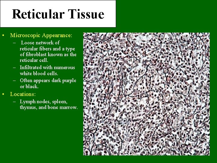 Reticular Tissue • Microscopic Appearance: – Loose network of reticular fibers and a type
