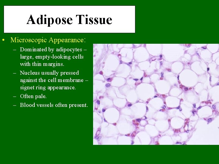 Adipose Tissue • Microscopic Appearance: – Dominated by adipocytes – large, empty-looking cells with