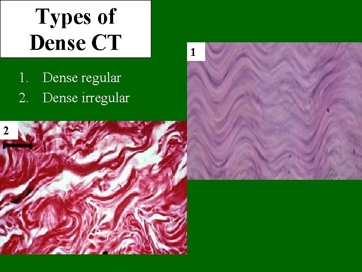 Types of Dense CT 1. Dense regular 2. Dense irregular 2 1 