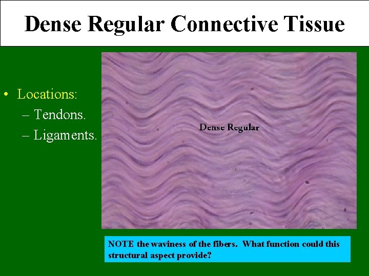 Dense Regular Connective Tissue • Locations: – Tendons. – Ligaments. NOTE the waviness of