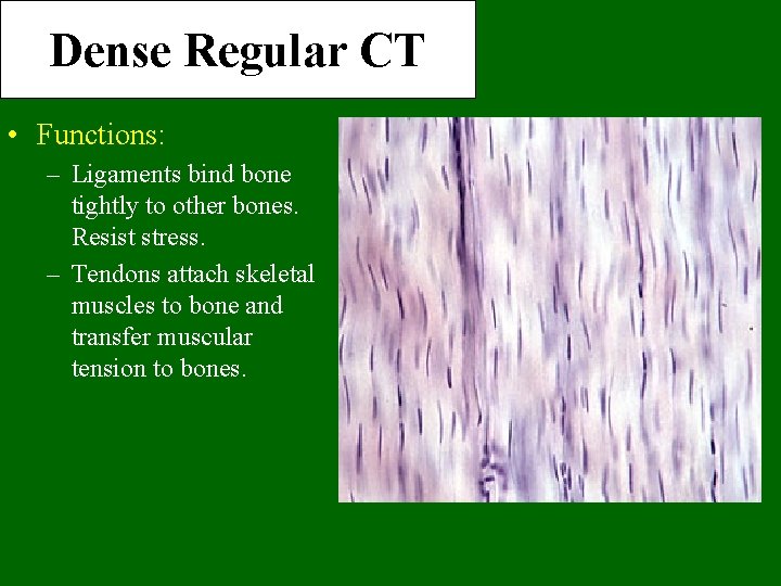 Dense Regular CT • Functions: – Ligaments bind bone tightly to other bones. Resist