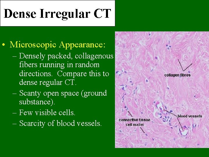 Dense Irregular CT • Microscopic Appearance: – Densely packed, collagenous fibers running in random