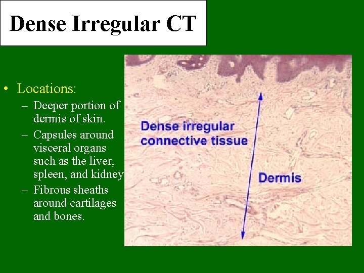 Dense Irregular CT • Locations: – Deeper portion of dermis of skin. – Capsules