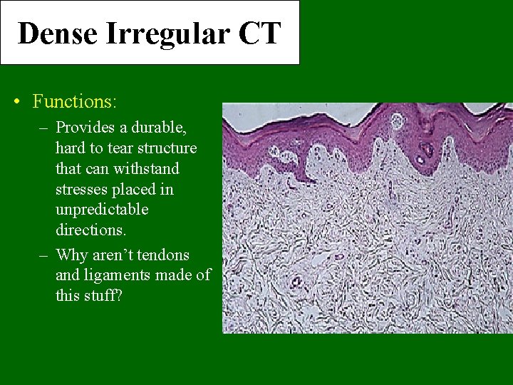 Dense Irregular CT • Functions: – Provides a durable, hard to tear structure that