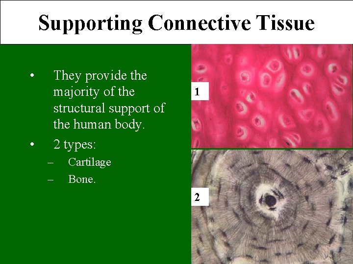 Supporting Connective Tissue • • They provide the majority of the structural support of