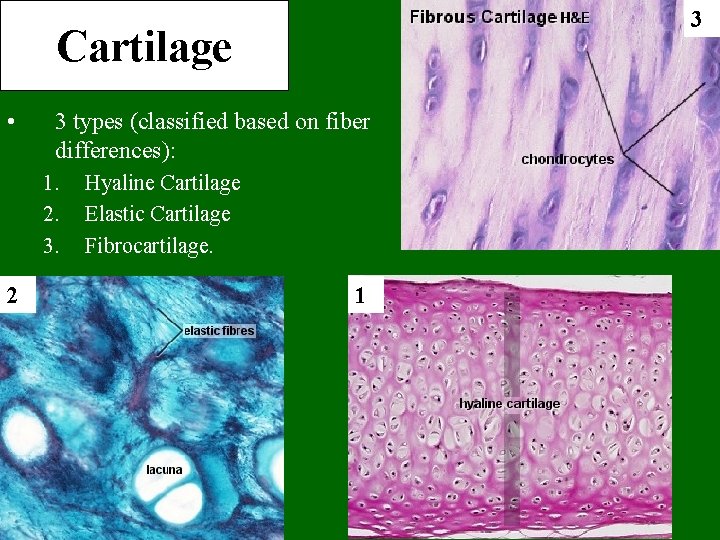 3 Cartilage • 3 types (classified based on fiber differences): 1. 2. 3. 2