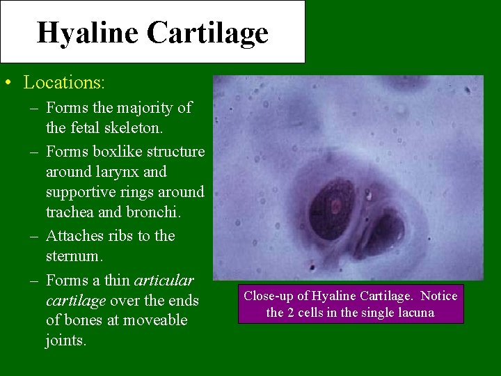 Hyaline Cartilage • Locations: – Forms the majority of the fetal skeleton. – Forms