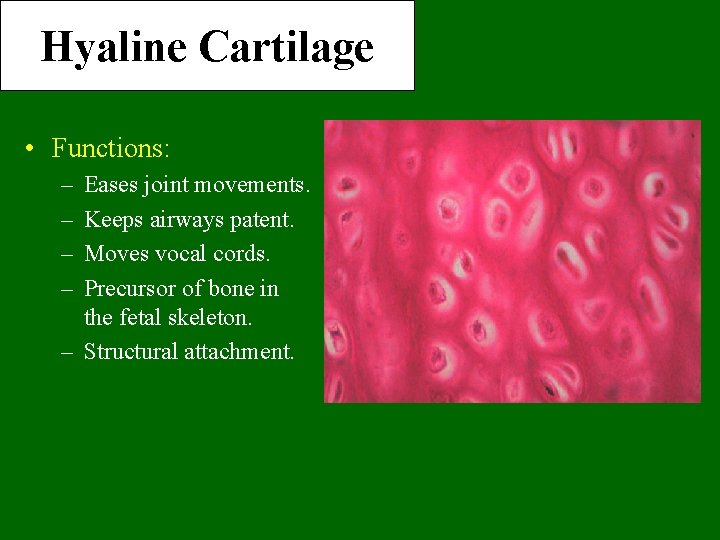 Hyaline Cartilage • Functions: – – Eases joint movements. Keeps airways patent. Moves vocal