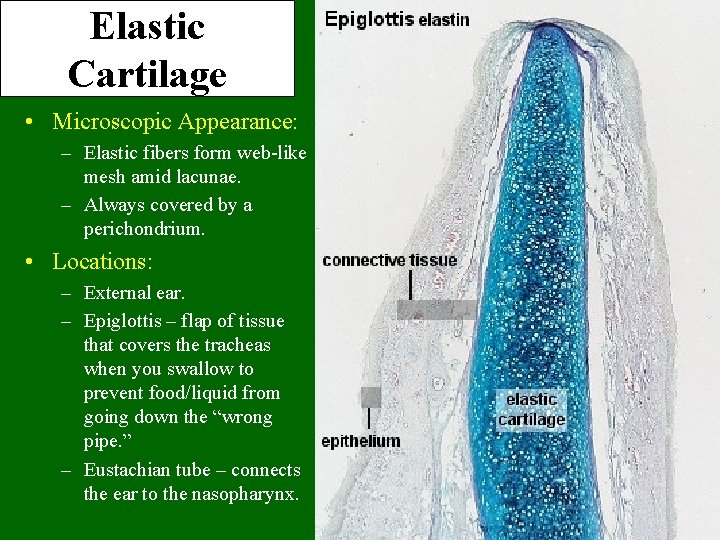 Elastic Cartilage • Microscopic Appearance: – Elastic fibers form web-like mesh amid lacunae. –