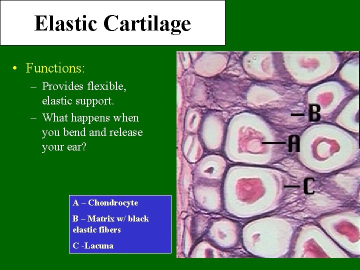 Elastic Cartilage • Functions: – Provides flexible, elastic support. – What happens when you