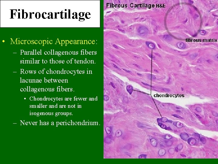 Fibrocartilage • Microscopic Appearance: – Parallel collagenous fibers similar to those of tendon. –