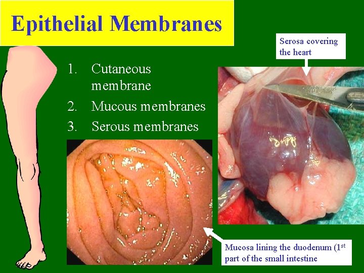 Epithelial Membranes Serosa covering the heart 1. Cutaneous membrane 2. Mucous membranes 3. Serous