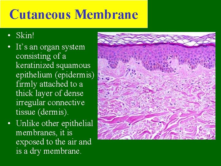 Cutaneous Membrane • Skin! • It’s an organ system consisting of a keratinized squamous