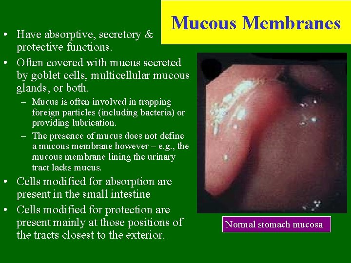 Mucous Membranes • Have absorptive, secretory & protective functions. • Often covered with mucus