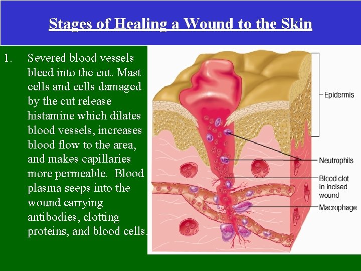 Stages of Healing a Wound to the Skin 1. Severed blood vessels bleed into
