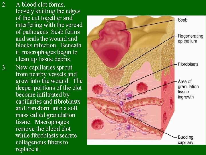 2. 3. A blood clot forms, loosely knitting the edges of the cut together