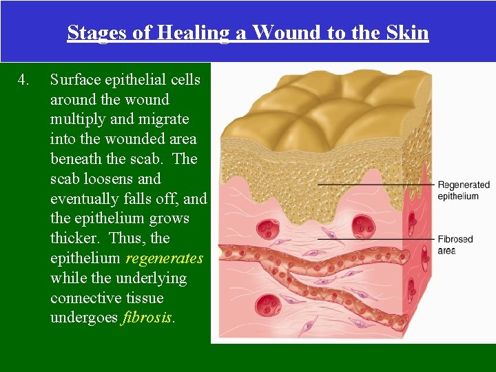 Stages of Healing a Wound to the Skin 4. Surface epithelial cells around the