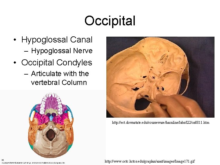 Occipital • Hypoglossal Canal – Hypoglossal Nerve • Occipital Condyles – Articulate with the Occipital • Hypoglossal Canal – Hypoglossal Nerve • Occipital Condyles – Articulate with the