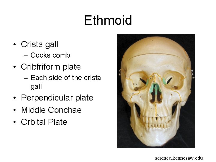 Ethmoid • Crista gall – Cocks comb • Cribfriform plate – Each side of Ethmoid • Crista gall – Cocks comb • Cribfriform plate – Each side of