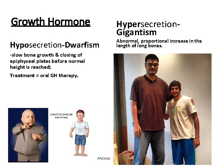 Growth Hormone Hyposecretion-Dwarfism -slow bone growth & closing of epiphyseal plates before normal height
