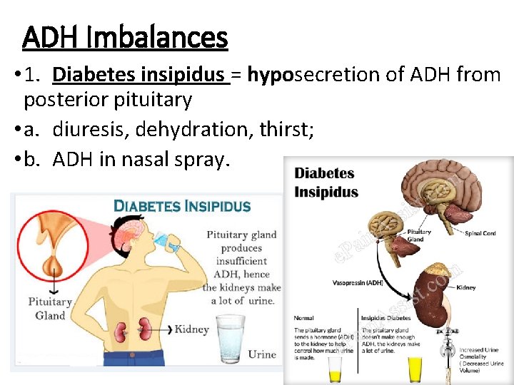 ADH Imbalances • 1. Diabetes insipidus = hyposecretion of ADH from posterior pituitary •