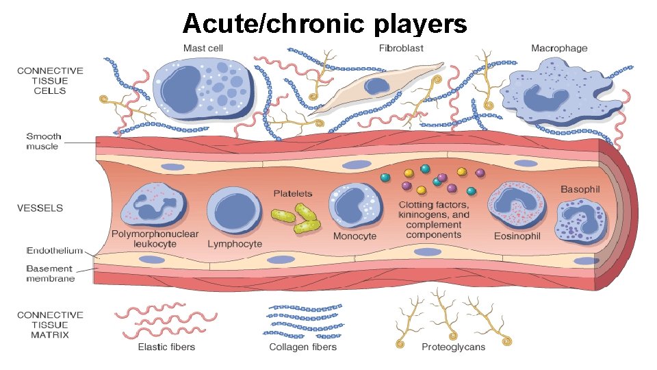 Acute/chronic players 