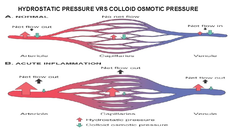 HYDROSTATIC PRESSURE VRS COLLOID OSMOTIC PRESSURE 