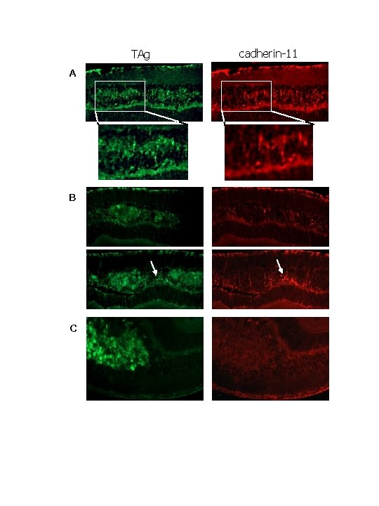 TAg A B C cadherin-11 