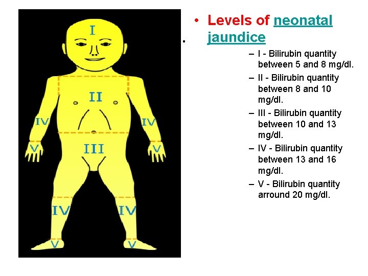 . • Levels of neonatal jaundice – I - Bilirubin quantity between 5 and