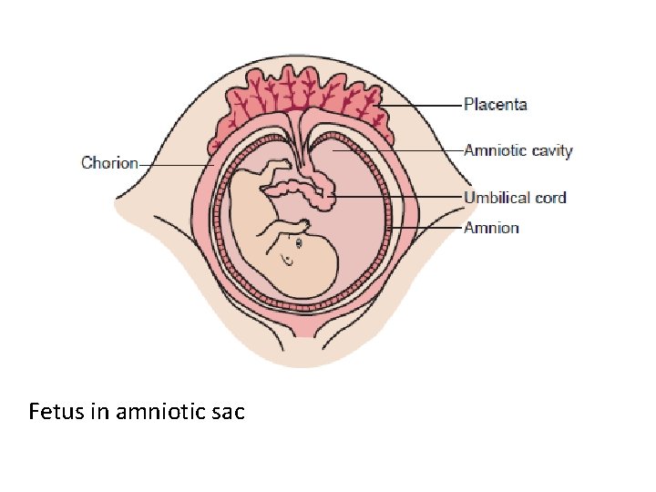 Fetus in amniotic sac 