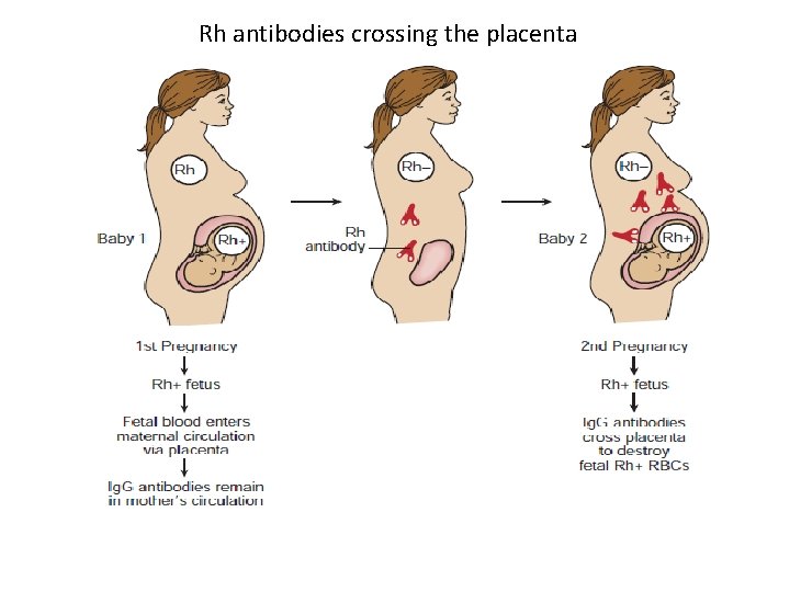 Rh antibodies crossing the placenta 