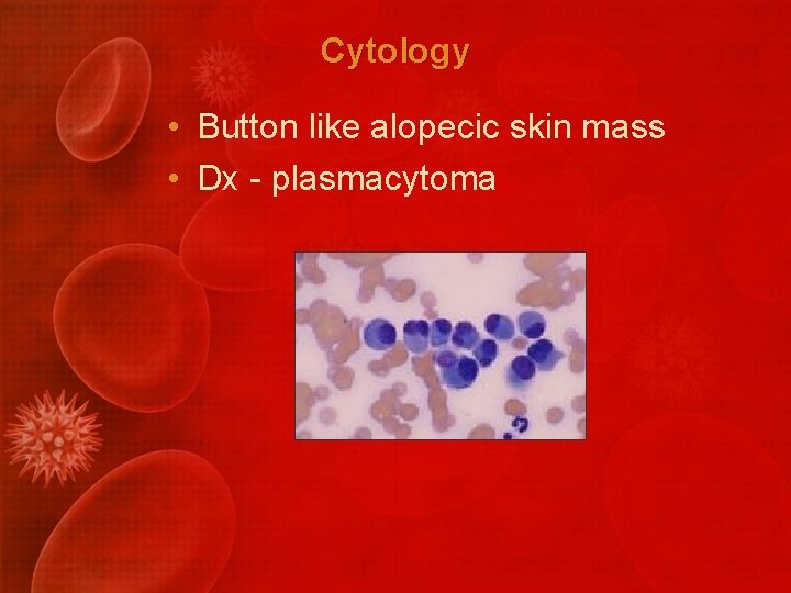 Cytology • Button like alopecic skin mass • Dx - plasmacytoma 