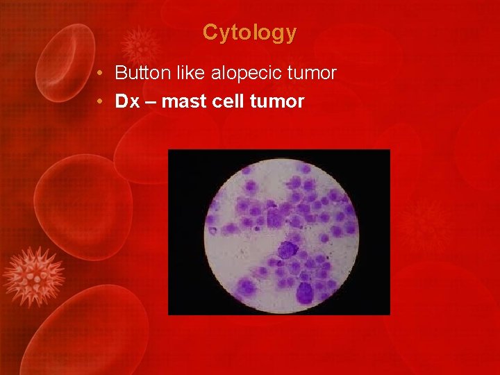 Cytology • Button like alopecic tumor • Dx – mast cell tumor 