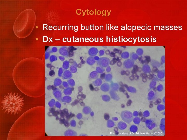 Cytology • Recurring button like alopecic masses • Dx – cutaneous histiocytosis 