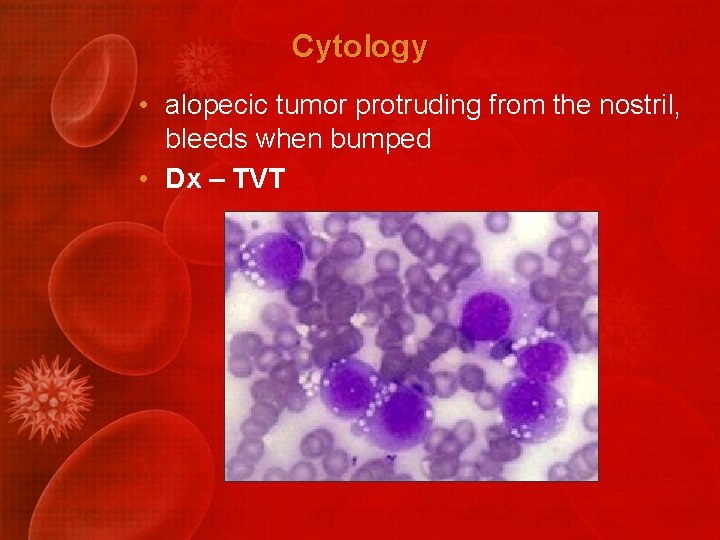 Cytology • alopecic tumor protruding from the nostril, bleeds when bumped • Dx –