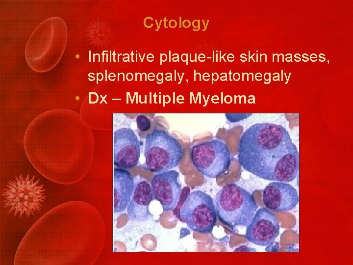 Cytology • Infiltrative plaque-like skin masses, splenomegaly, hepatomegaly • Dx – Multiple Myeloma 