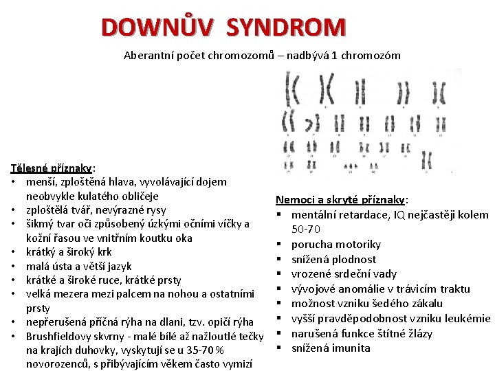 DOWNŮV SYNDROM Aberantní počet chromozomů – nadbývá 1 chromozóm Tělesné příznaky: • menší, zploštěná