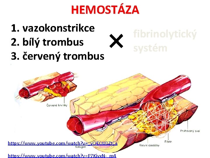 HEMOSTÁZA 1. vazokonstrikce 2. bílý trombus 3. červený trombus https: //www. youtube. com/watch? v=_y.