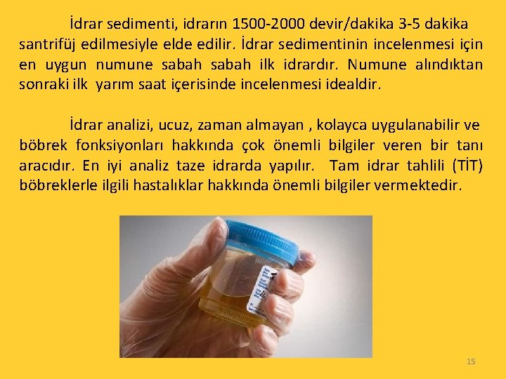 İdrar sedimenti, idrarın 1500 -2000 devir/dakika 3 -5 dakika santrifüj edilmesiyle elde edilir. İdrar