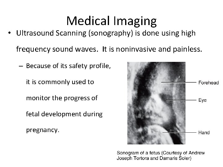 Medical Imaging • Ultrasound Scanning (sonography) is done using high frequency sound waves. It