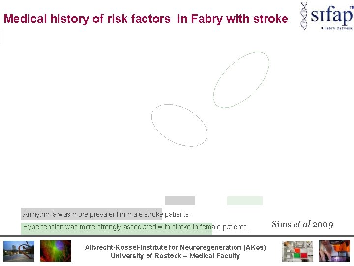 Medical history of risk factors in Fabry with stroke Arrhythmia was more prevalent in