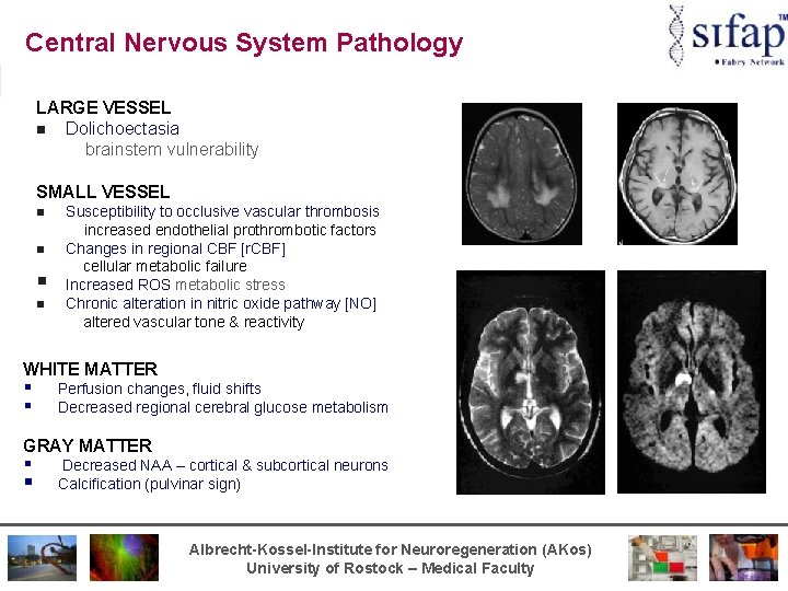 Central Nervous System Pathology LARGE VESSEL n Dolichoectasia brainstem vulnerability SMALL VESSEL n n