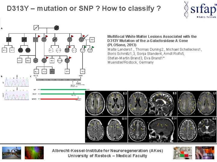 D 313 Y – mutation or SNP ? How to classify ? Multifocal White