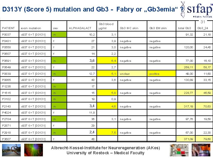 D 313 Y (Score 5) mutation and Gb 3 - Fabry or „Gb 3