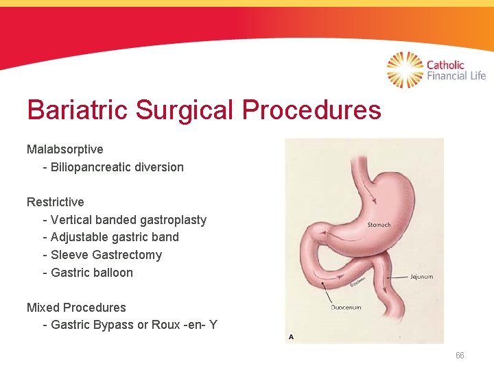 Bariatric Surgical Procedures Malabsorptive - Biliopancreatic diversion Restrictive - Vertical banded gastroplasty - Adjustable