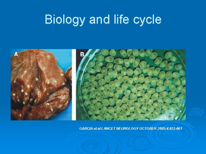 Biology and life cycle GARCIA et al LANCET NEUROLOGY OCTOBER 2005; 4: 653 -661