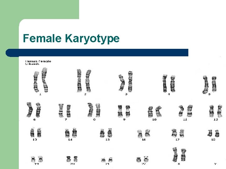 Female Karyotype 