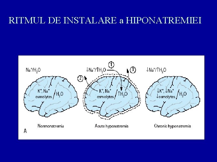 RITMUL DE INSTALARE a HIPONATREMIEI 